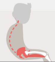 Posterior Pelvic Tilt (+ sagittal pelvic angle)