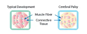 Increased amount of connective tissue