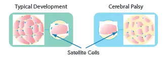 Reduced number of satellite cells